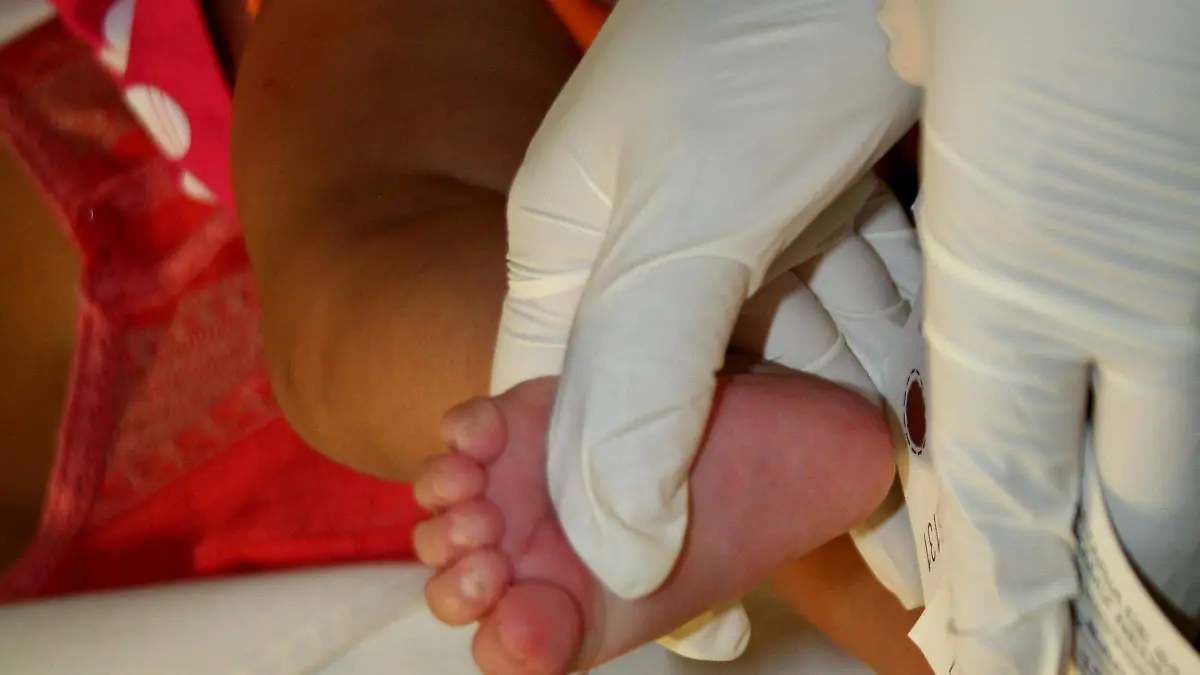 Tamiz Neonatal