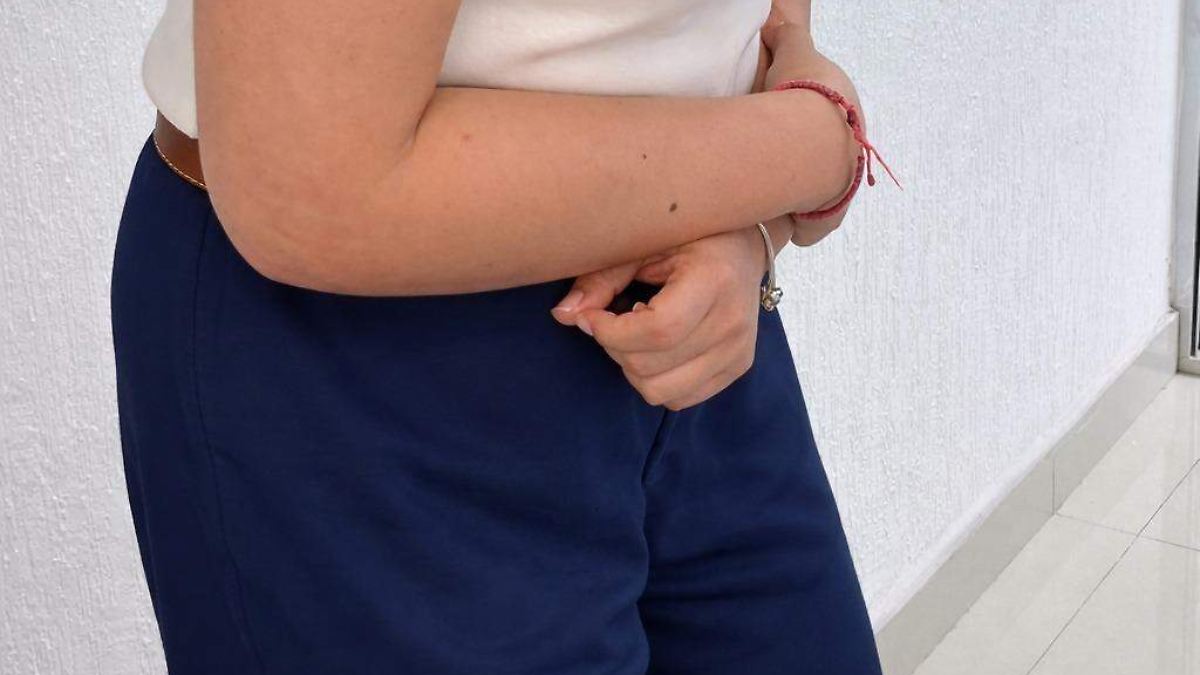 直腸がんと結腸がん：その症状とその見分け方は何ですか? – サンルイスの太陽