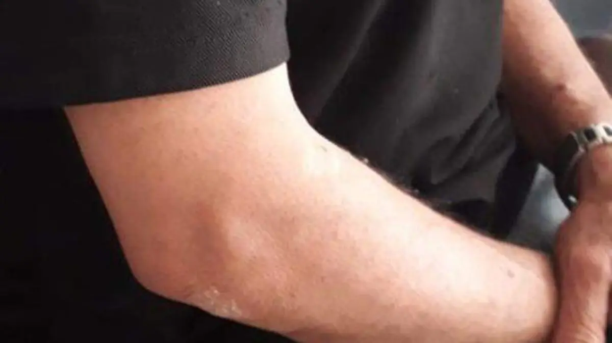 disculpa, está en libertad