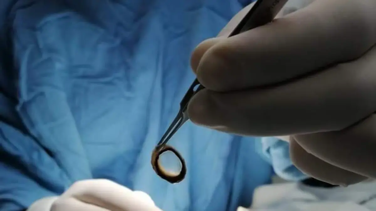 Donación de órganos y su llamado a la población