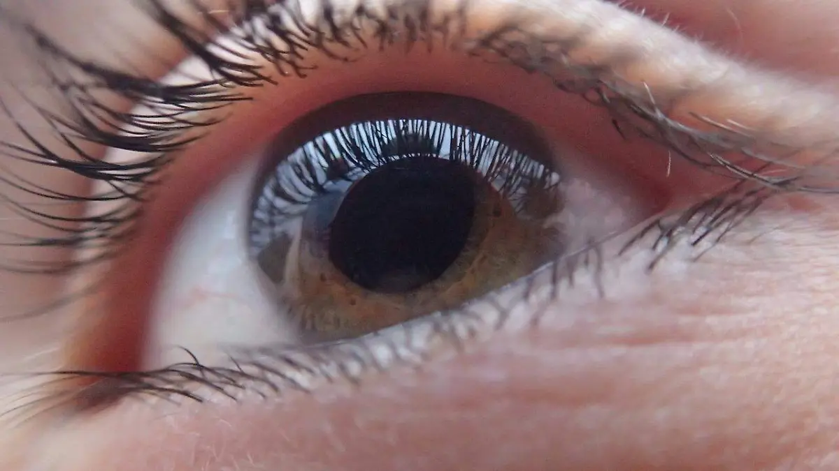 Glaucoma y cataratas, un mal que afecta la vista 
