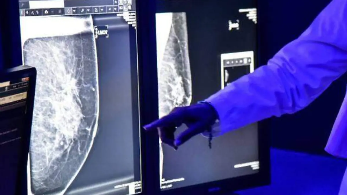 Clinica_Cancer_Mama-CUARTOSCURO