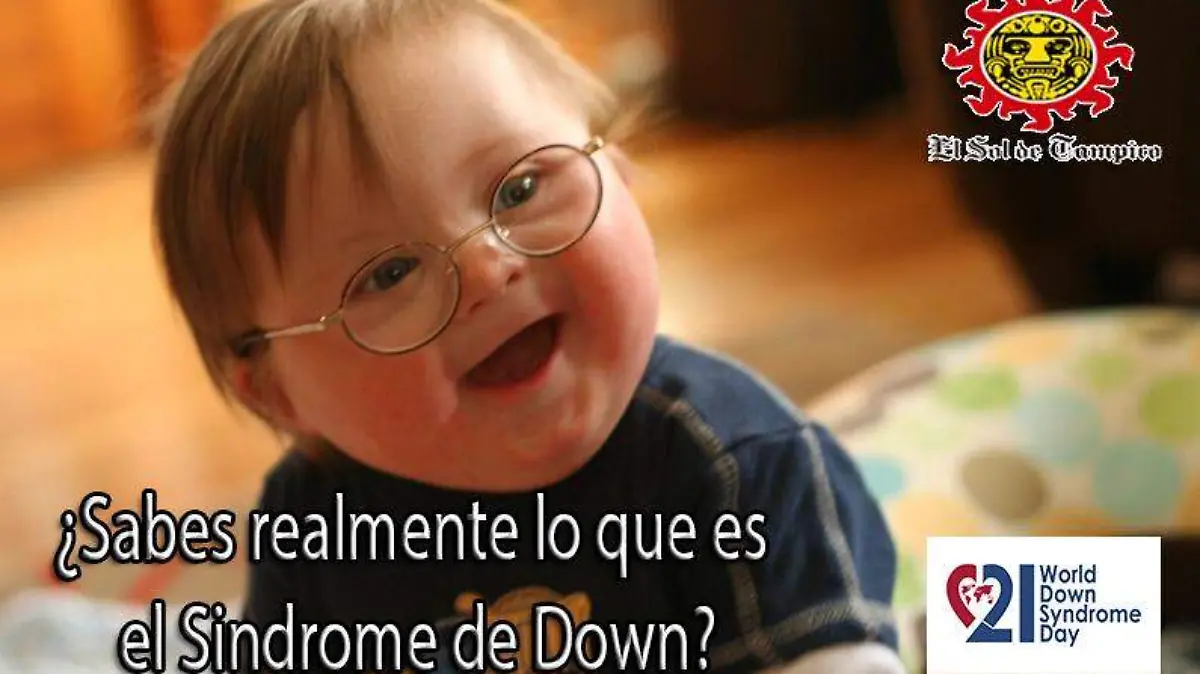 downssyndromnfokus copia