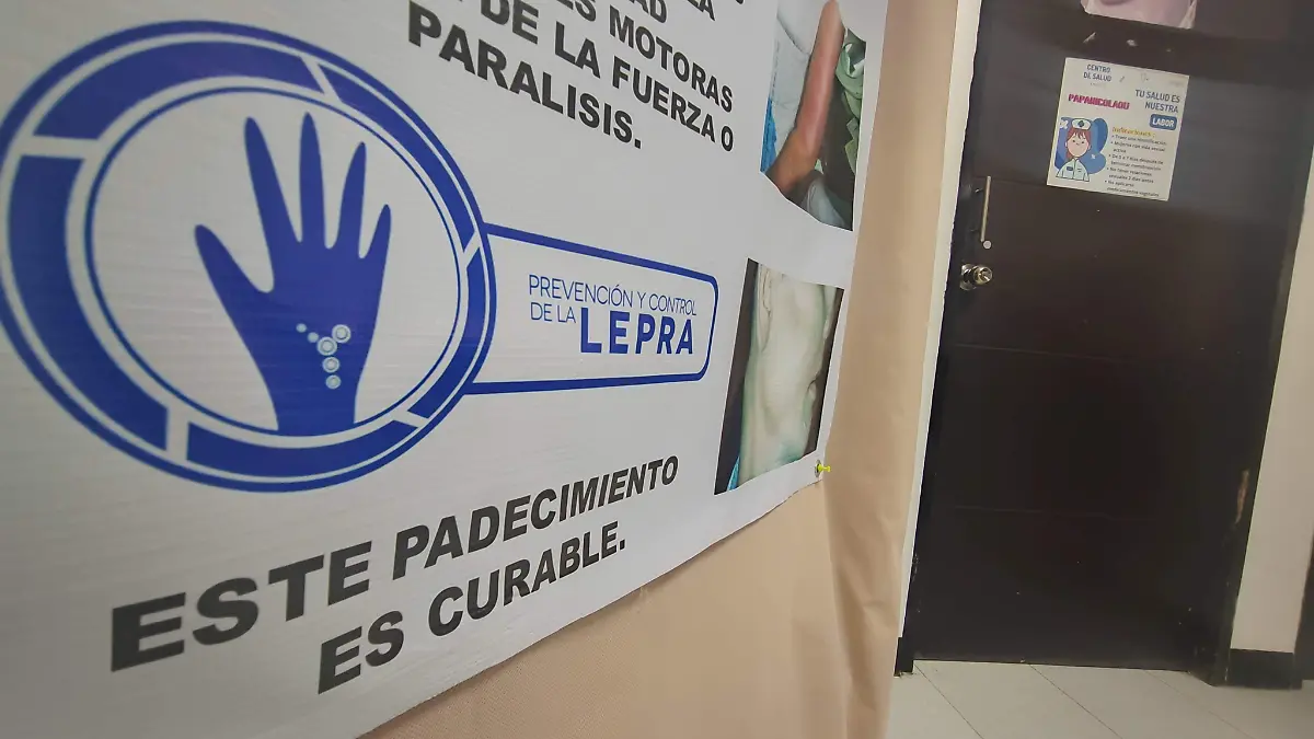 La lepra es tratable