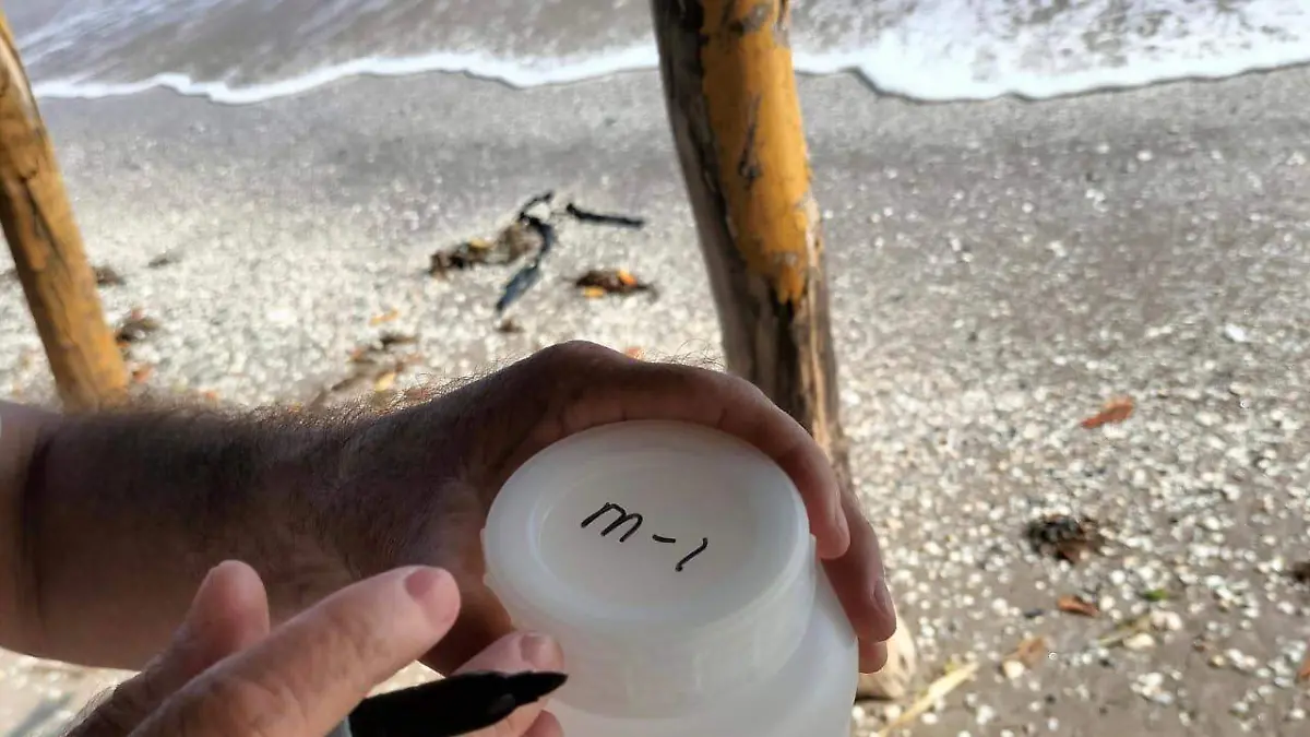 Una de las bacterias que más preocupa a las autoridades es la de enterococos