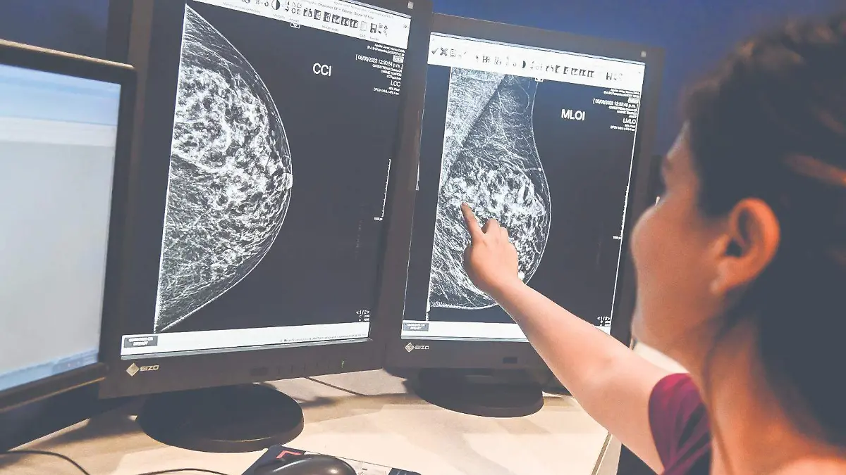 Medicina de innovación en Tampico, los avances en la detección de cáncer de mama1
