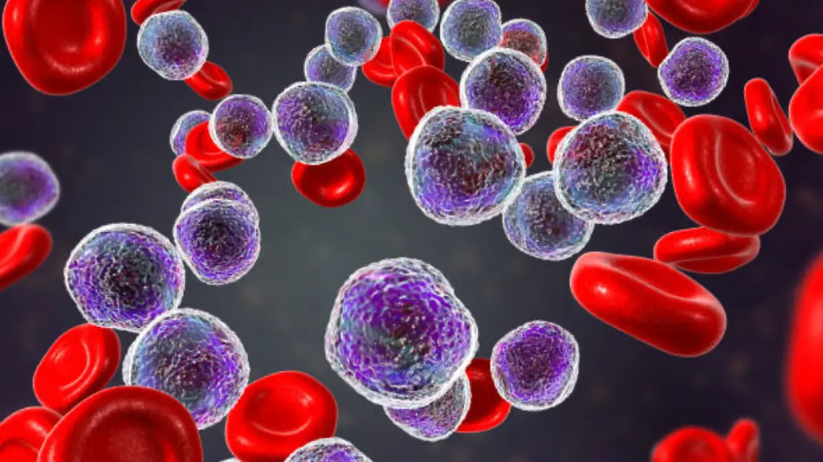 Mujer solicita apoyo para tratamiento de leucemia