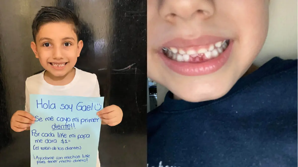 A Gael se le cayó su primer diente, ahora el 'ratón' le dará un peso por cada 'me gusta'