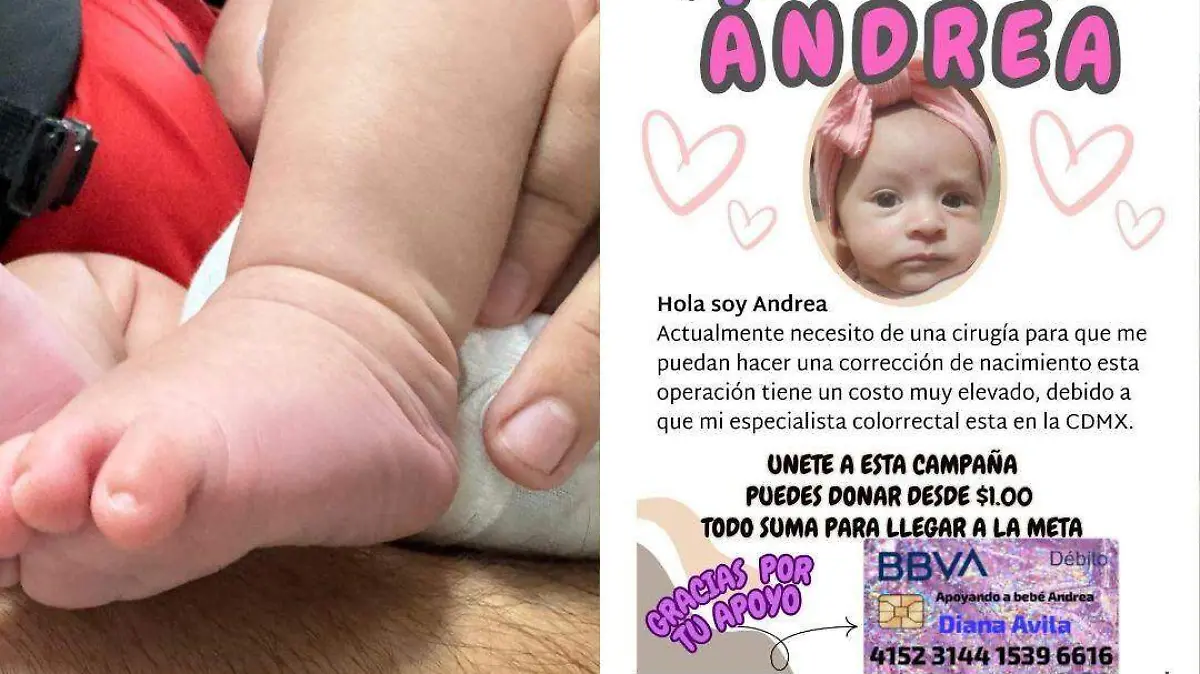 FOTOS