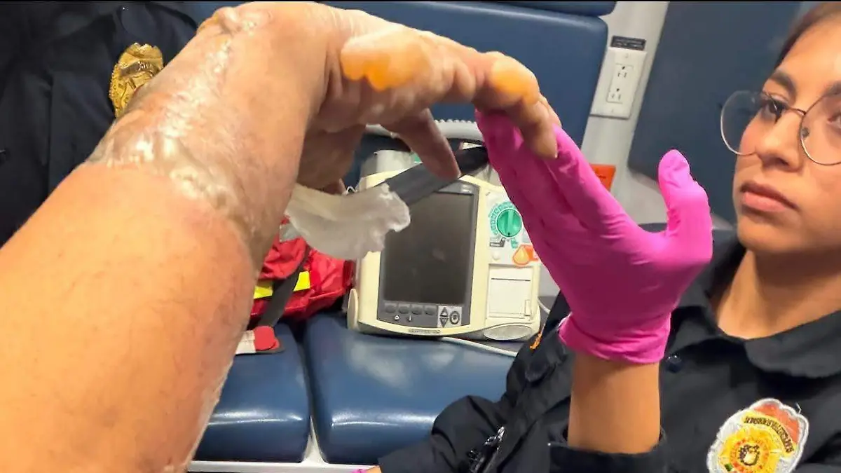 Lesionado por pirotecnia en Altamira