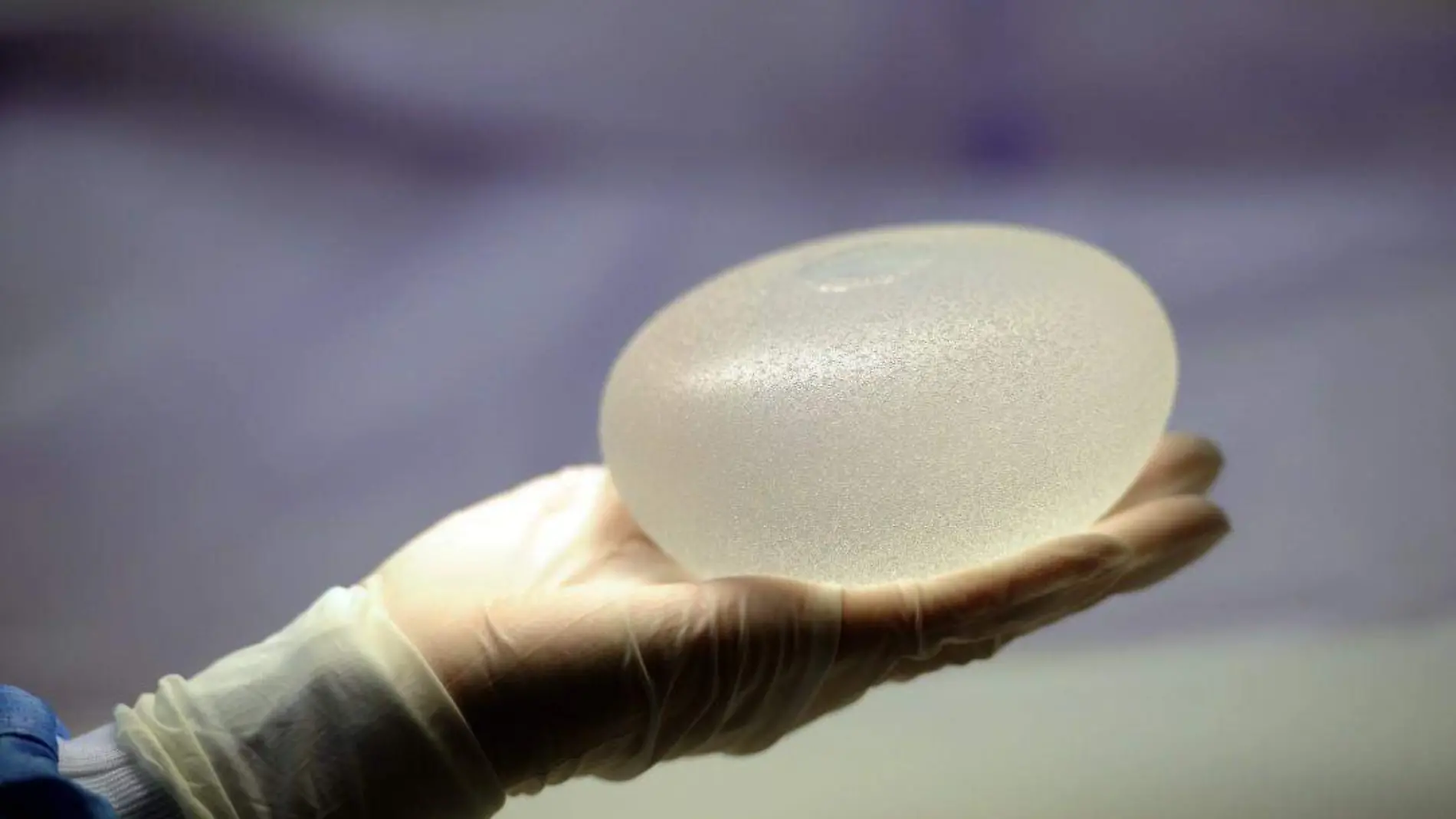 170321223542-silicone-breast-implant-super-169