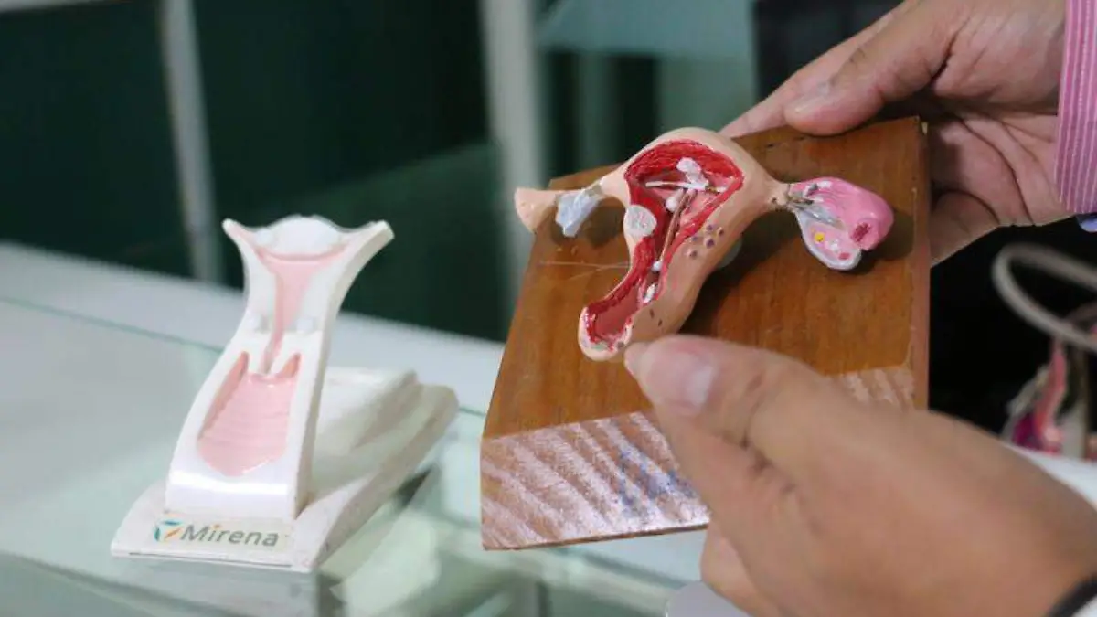 Cáncer cervicouterino