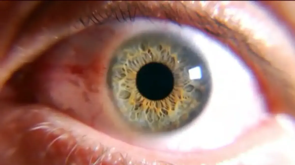OJO 2