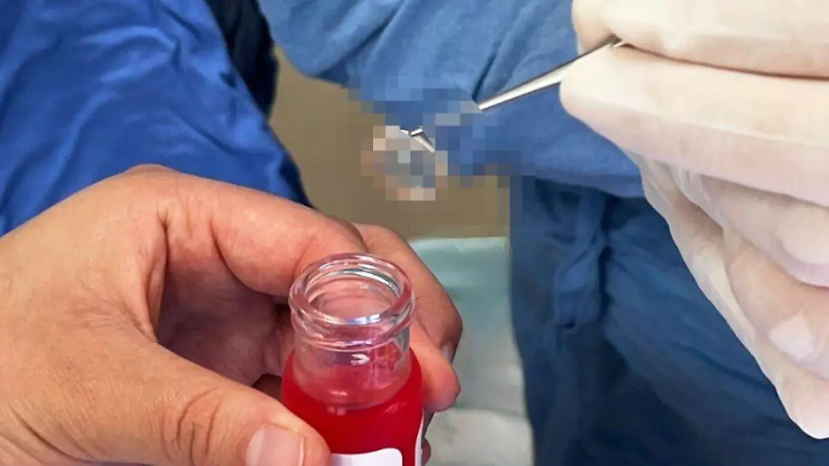 Procuración Córnea en este año