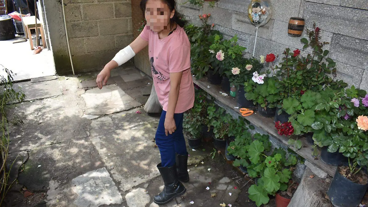 Ataque de perros (2)