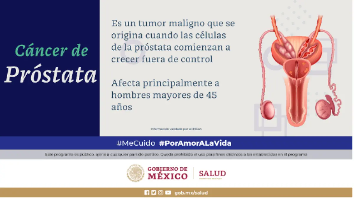 CÁNCER DE PRÓSTATA