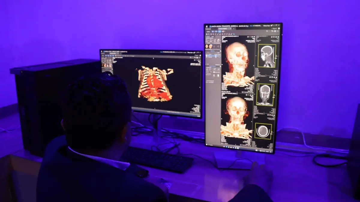 EQUIPAMIENTO ITAES 3