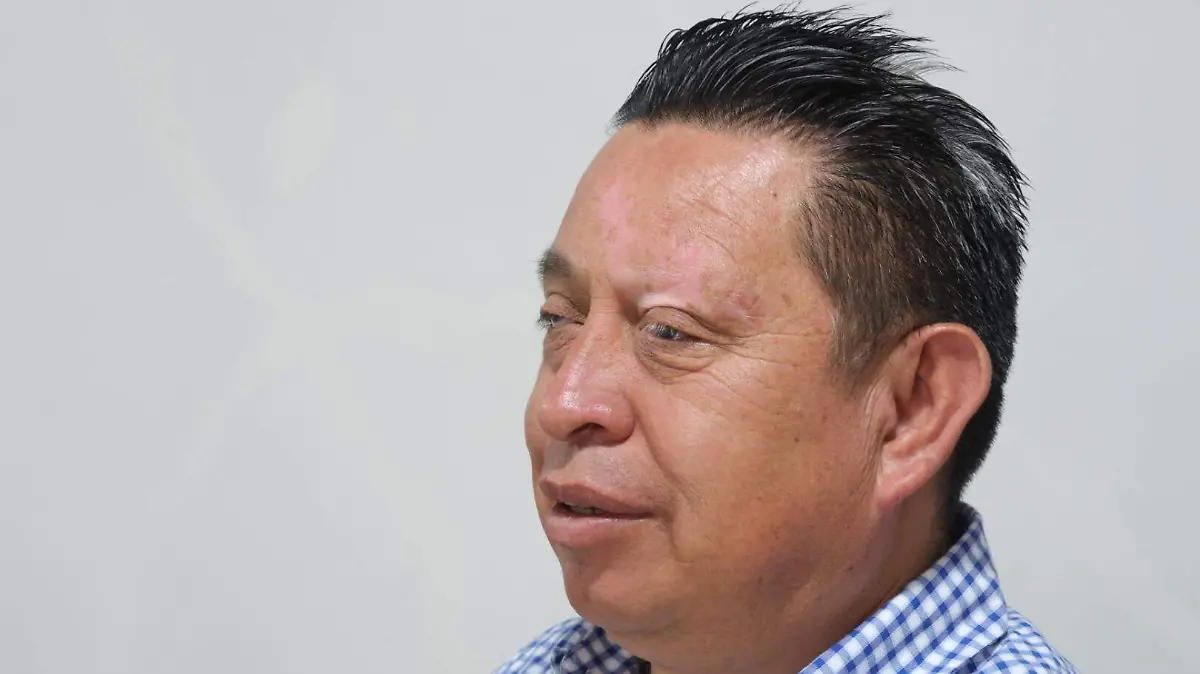 Gabino Flores Albinismo3