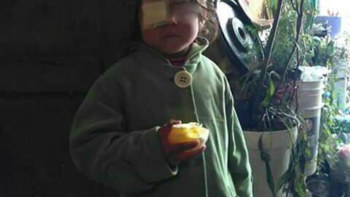 niña cáncer