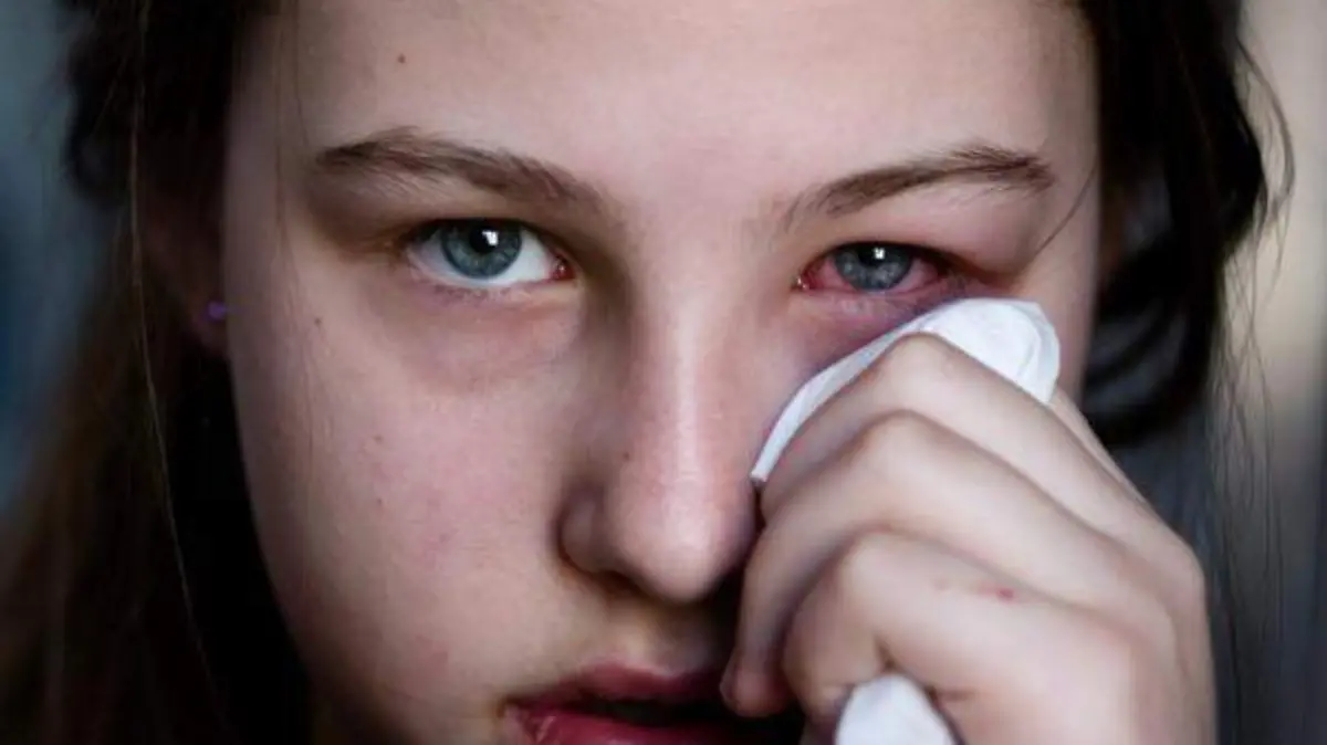 ojos