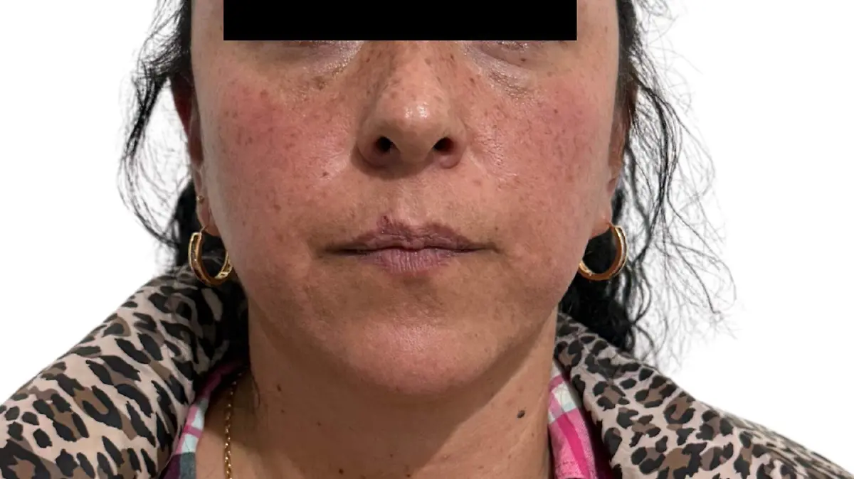 operativo enjambre 2