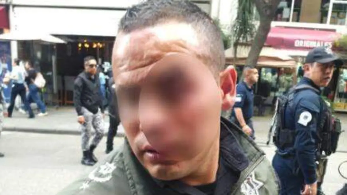 policia-herido-en -la-ceja-en-toluca