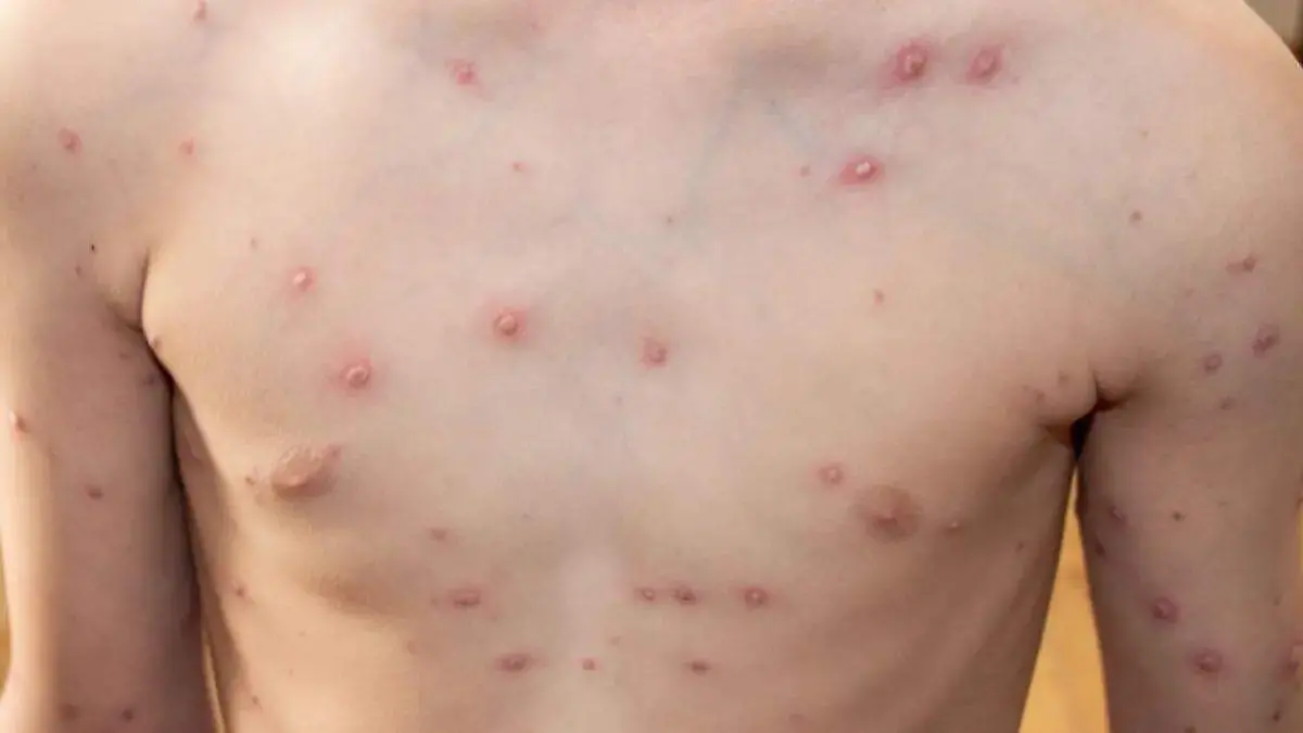 WhatsApp Image 2026-02-11 at 5.50.39 PM