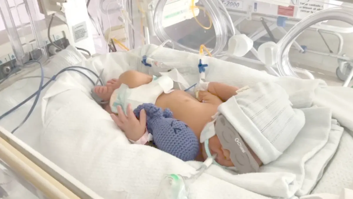 Atención a menores prematuros en el ISSSTE
