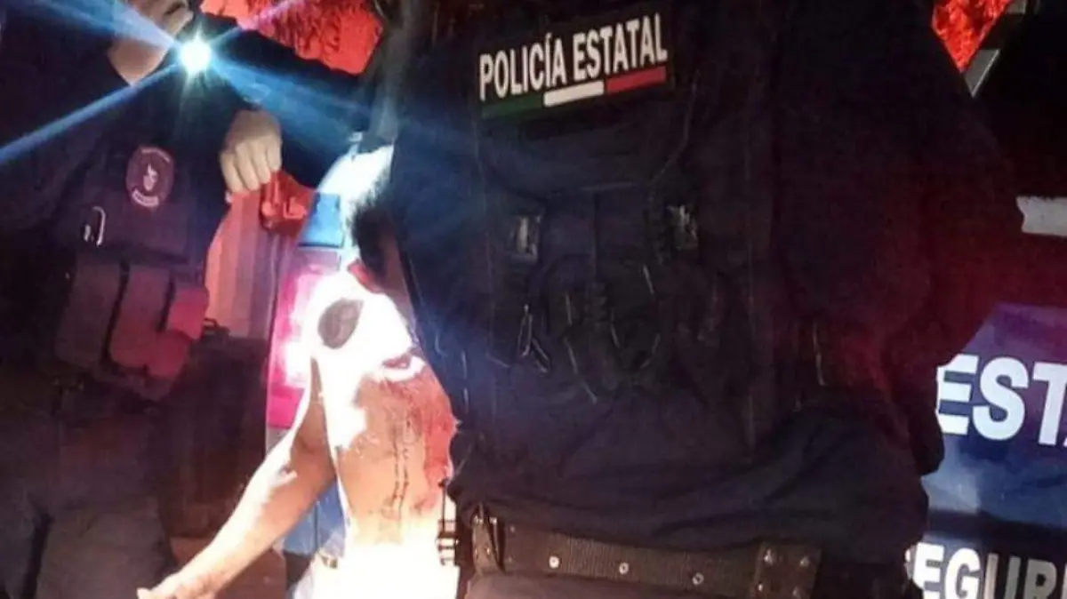 llega golpeado a su casa