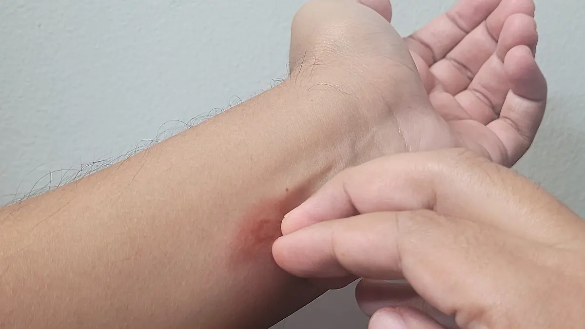 como evitar el dengue 