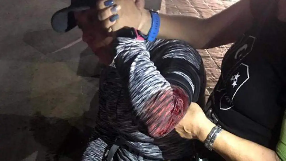 Ataque de Perro en el malecón La Paz