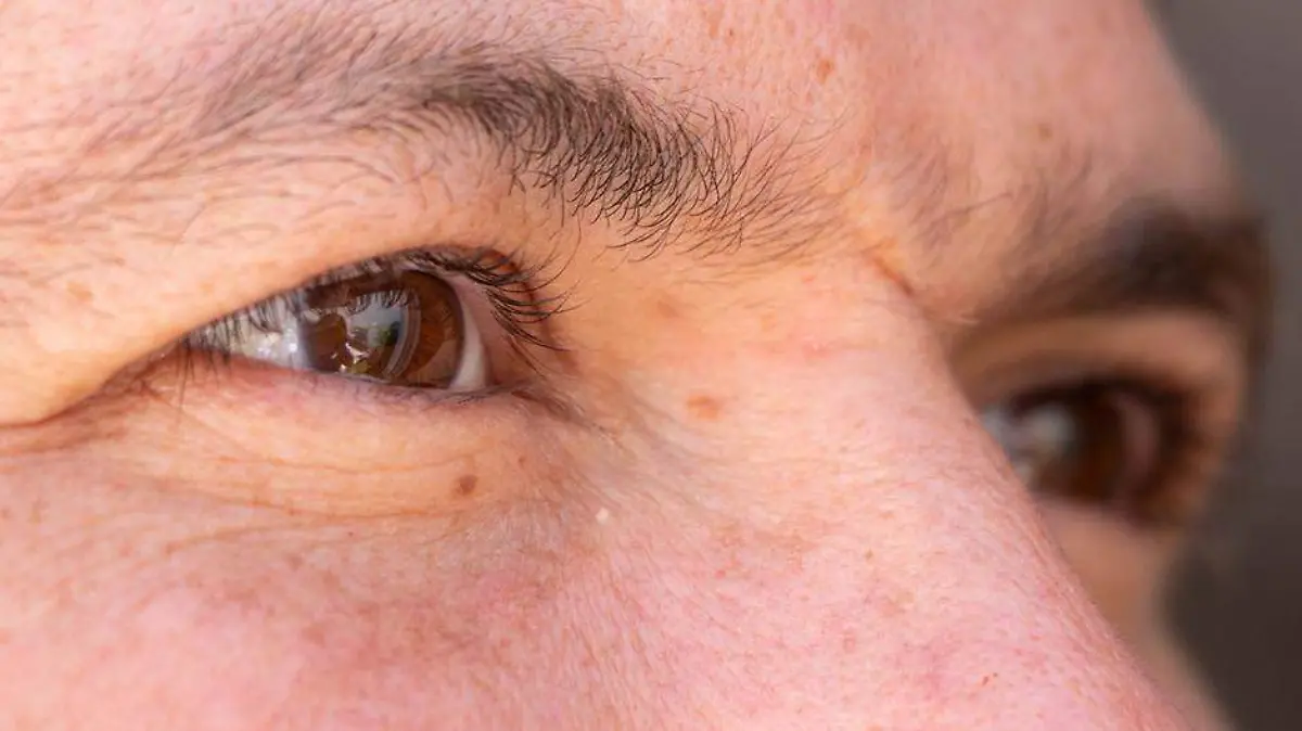 DESPRENDIMIENTO VITREO 1