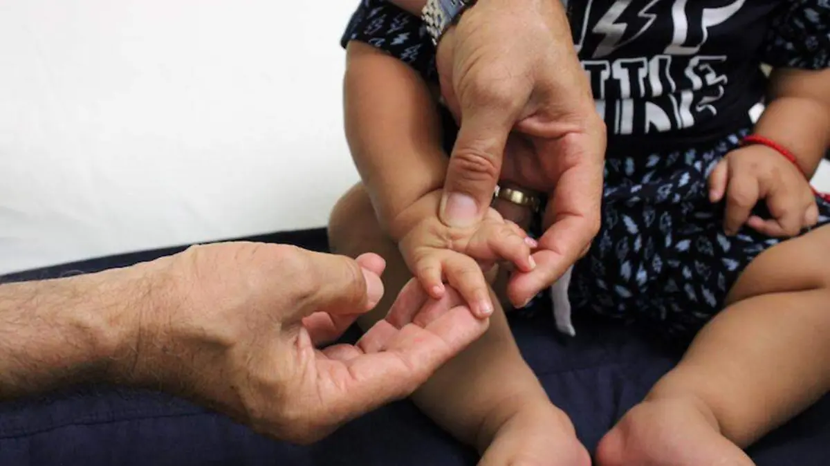 GOB SSA CIRUGIAS MANOS