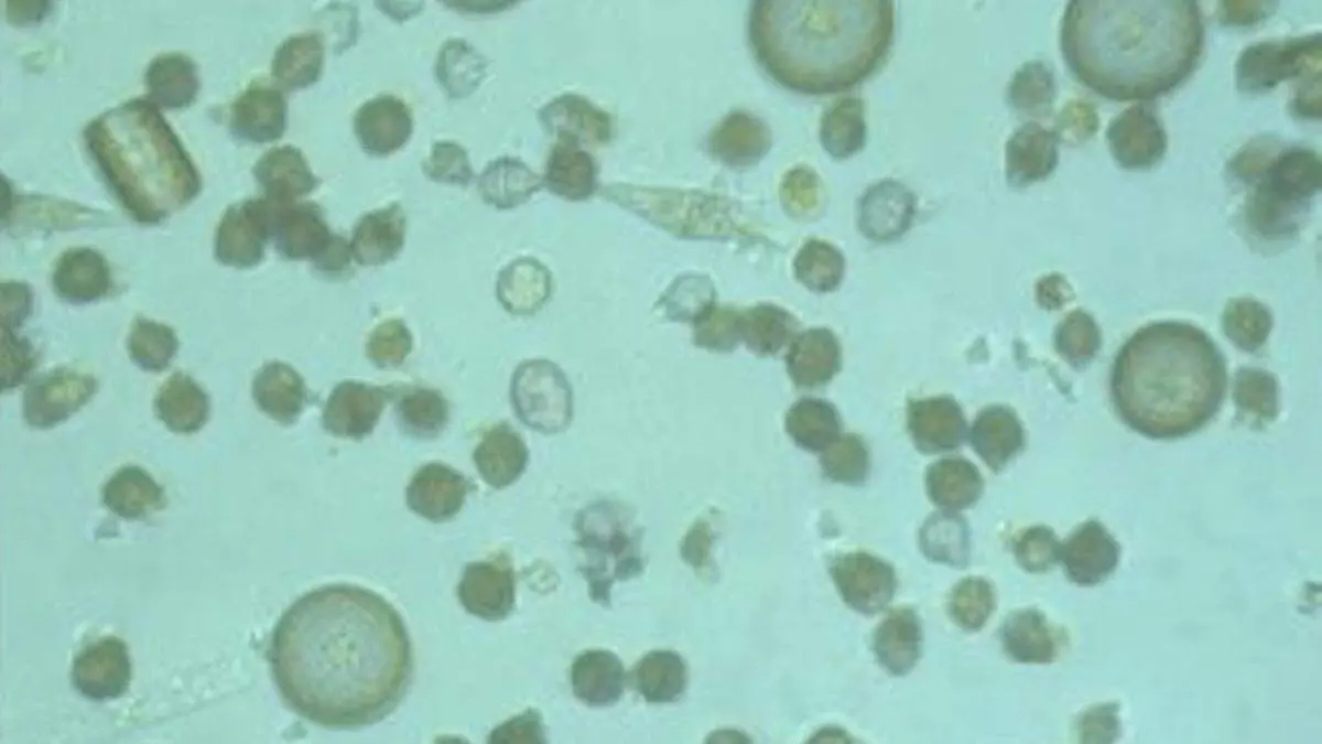 florecimiento algal nocivo en aguas de La Paz