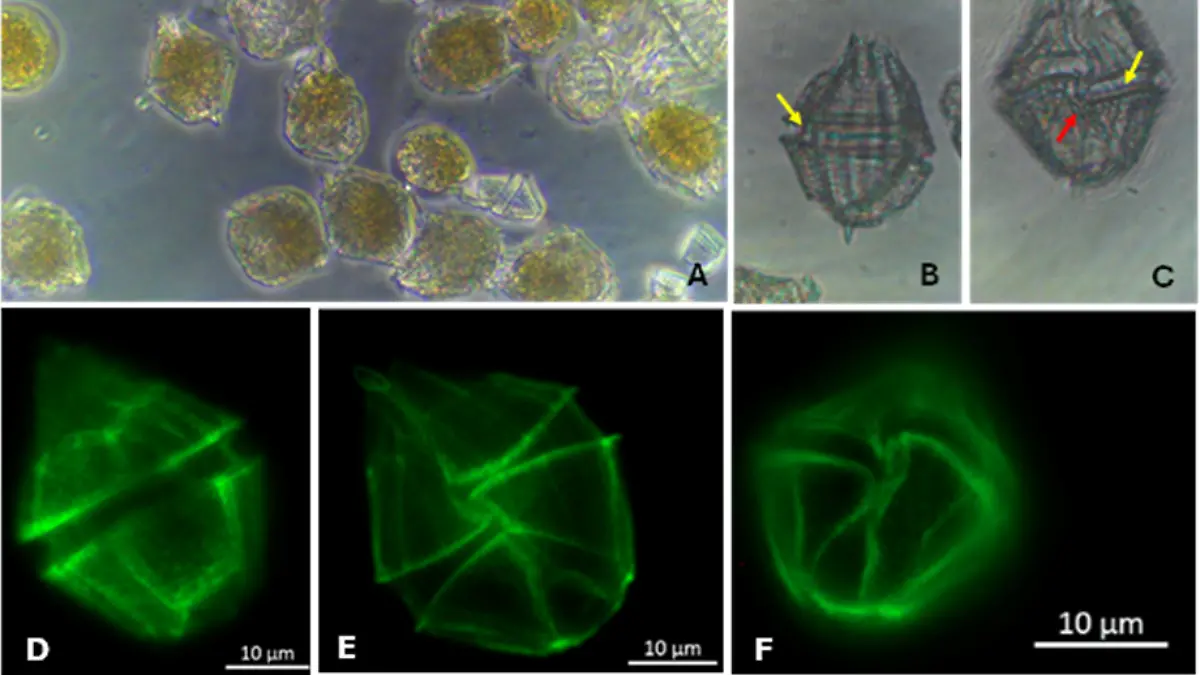 peces globo alga toxica la paz 