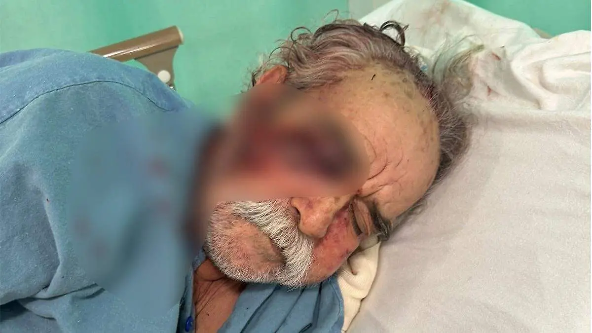 amao-manriquez-victima-de-agresion