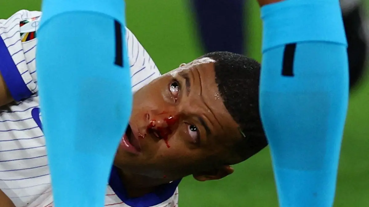 Euro 2024   Austria v France