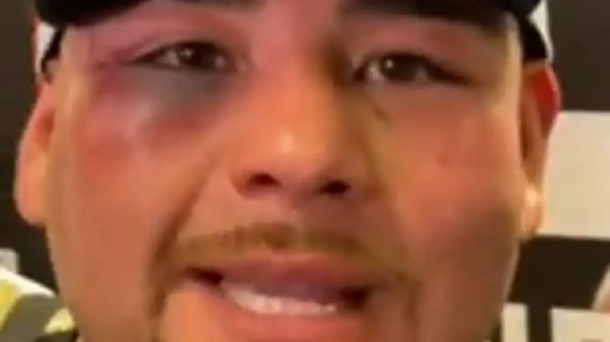 Nuevo proyecto 2022 09 06T170602.519