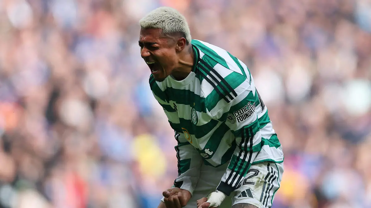 2026-03-08T134020Z_1665264317_UP1EM3811Z7WP_RTRMADP_3_SOCCER-SCOTLAND-RAN-CEL