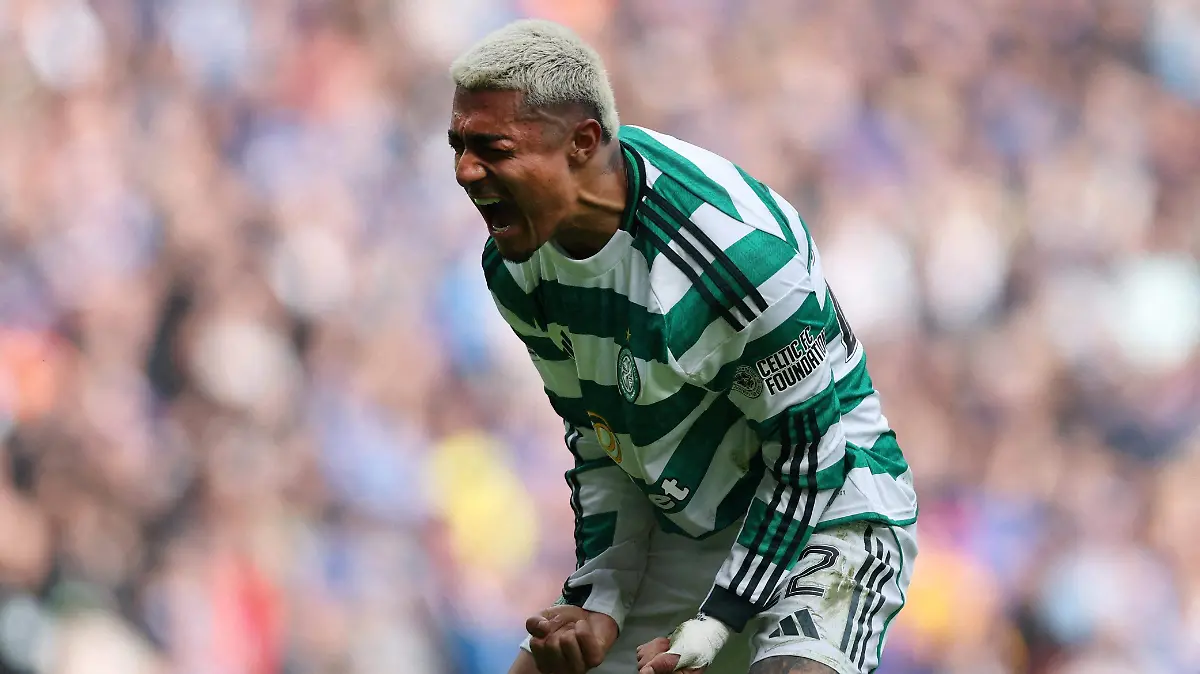 2026-03-08T160959Z_1807270839_UP1EM3811Z7WP_RTRMADP_3_SOCCER-SCOTLAND-RAN-CEL