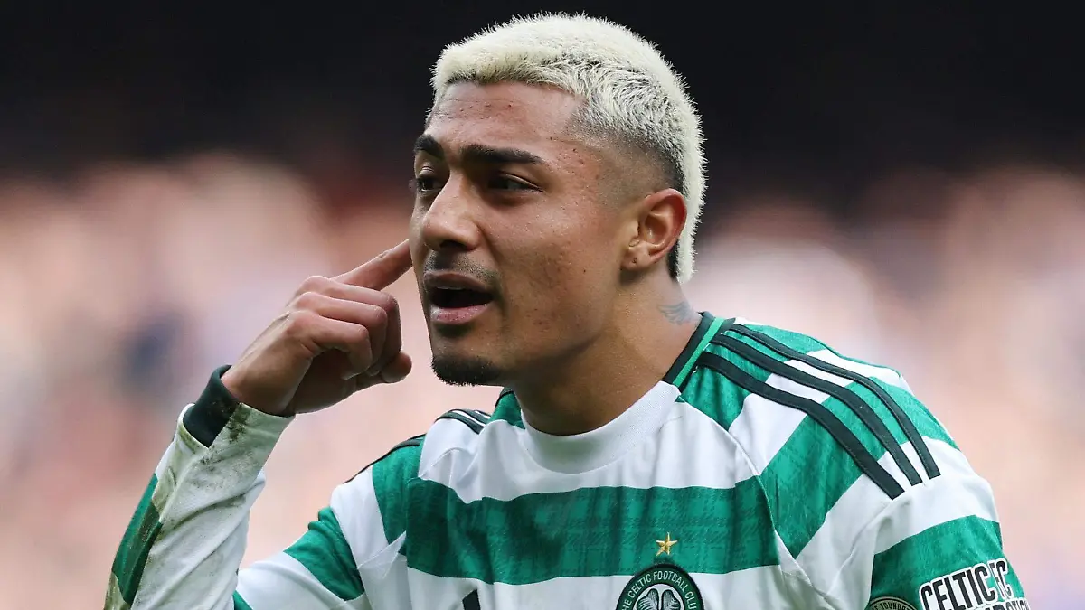 2026-03-08T134042Z_1417292724_UP1EM3811ZSWT_RTRMADP_3_SOCCER-SCOTLAND-RAN-CEL