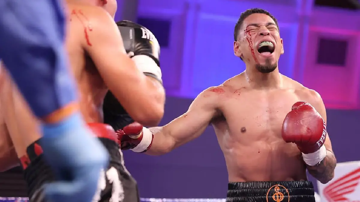 Smiley Pérez pierde