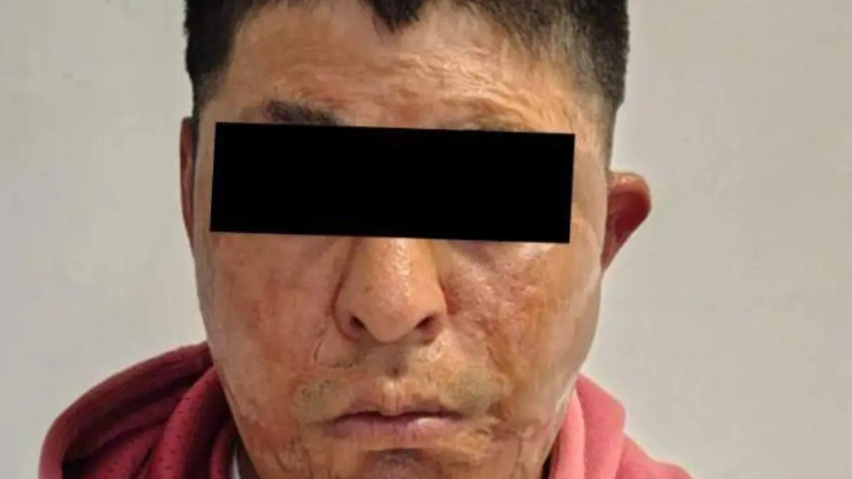 Cateo en Álvaro Obregón