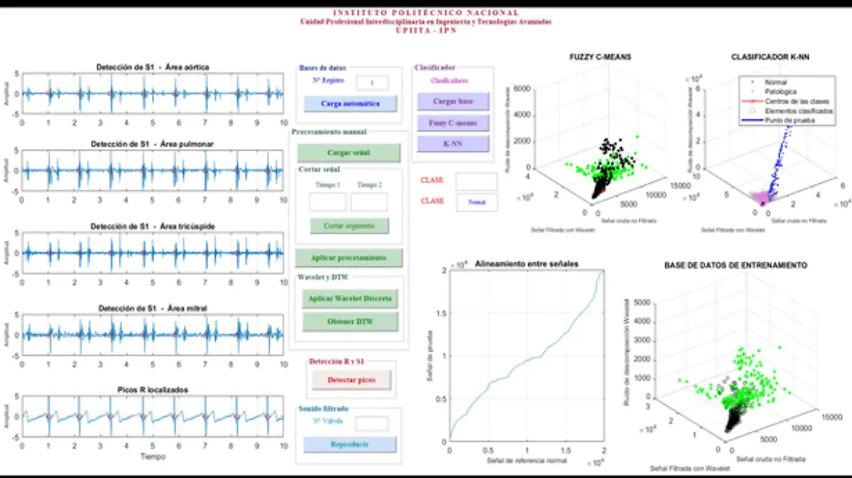 IPN-desarrolla-sistema-para-detectar-fallas-cardiacas-(1)