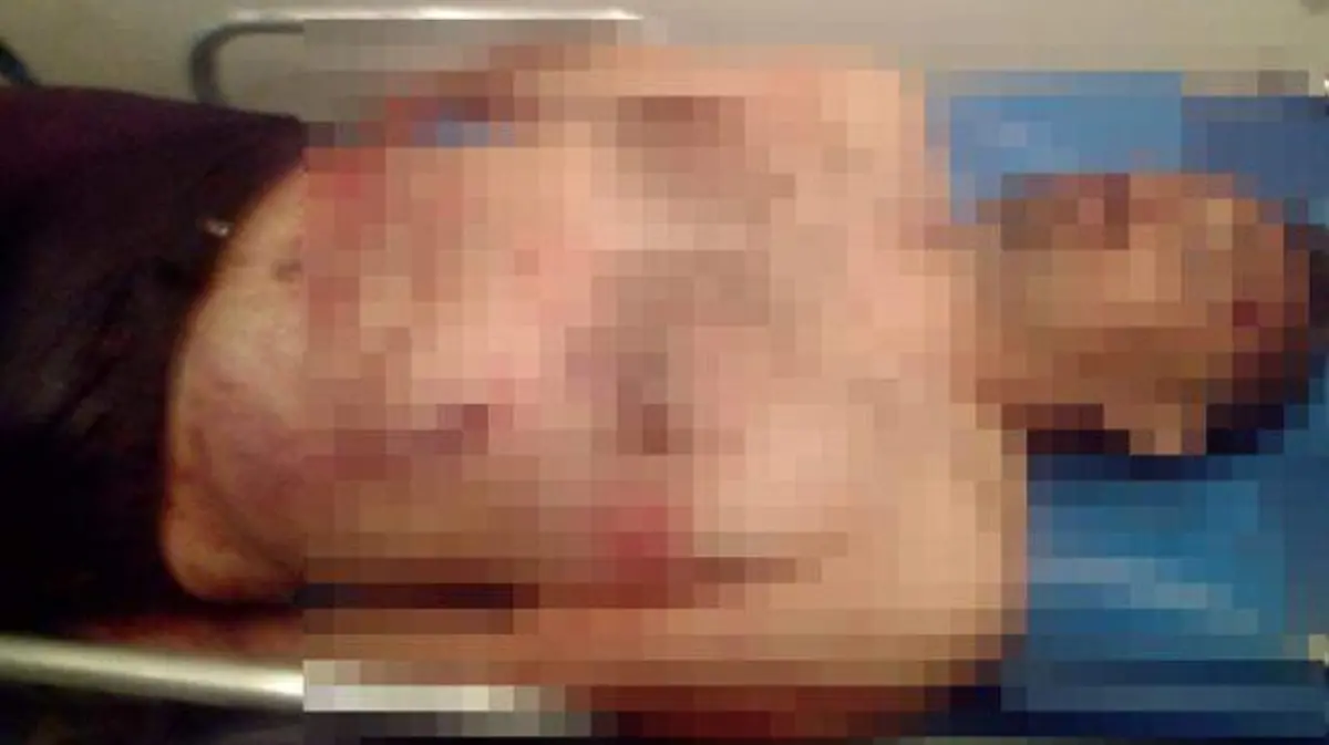 muerto-valle-de-chalco