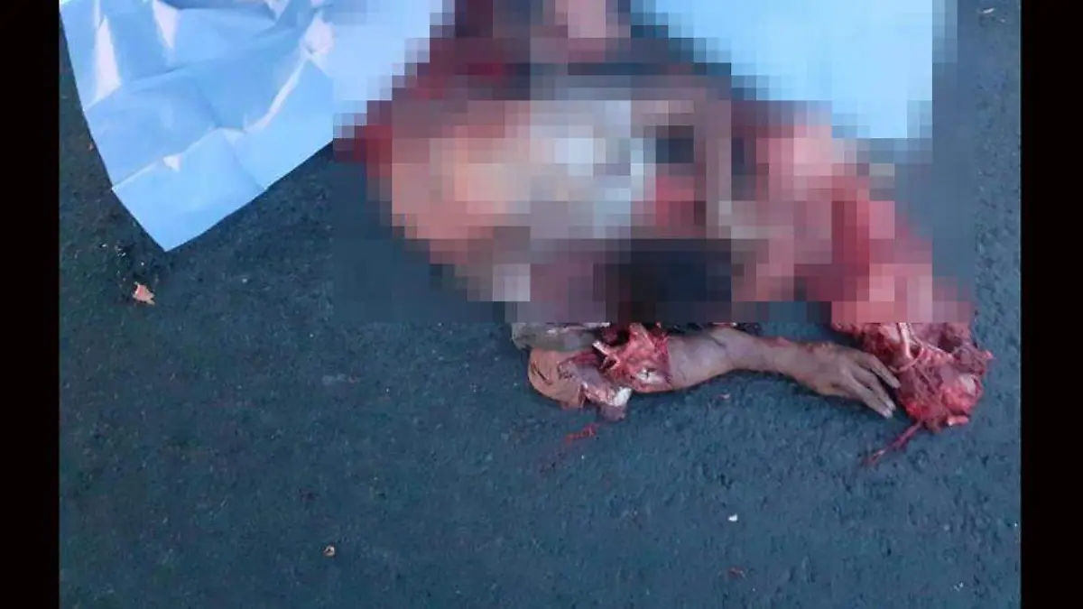 atropellado-México-Pachuca