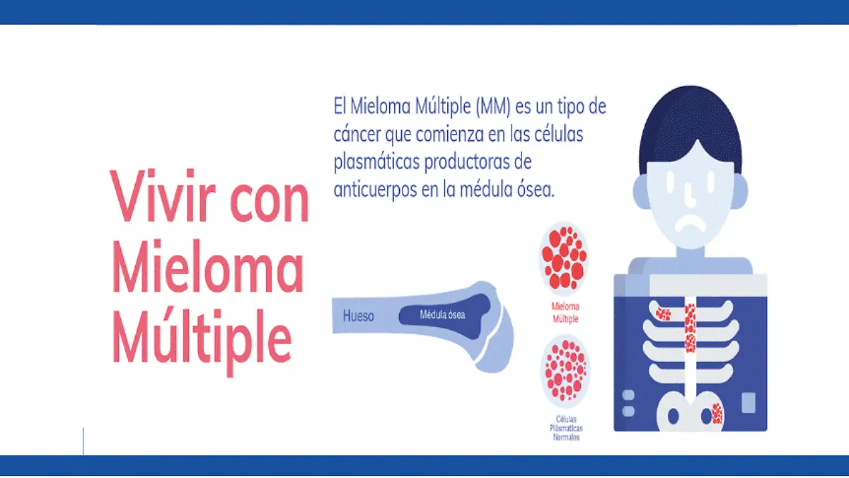 mieloma-multiple
