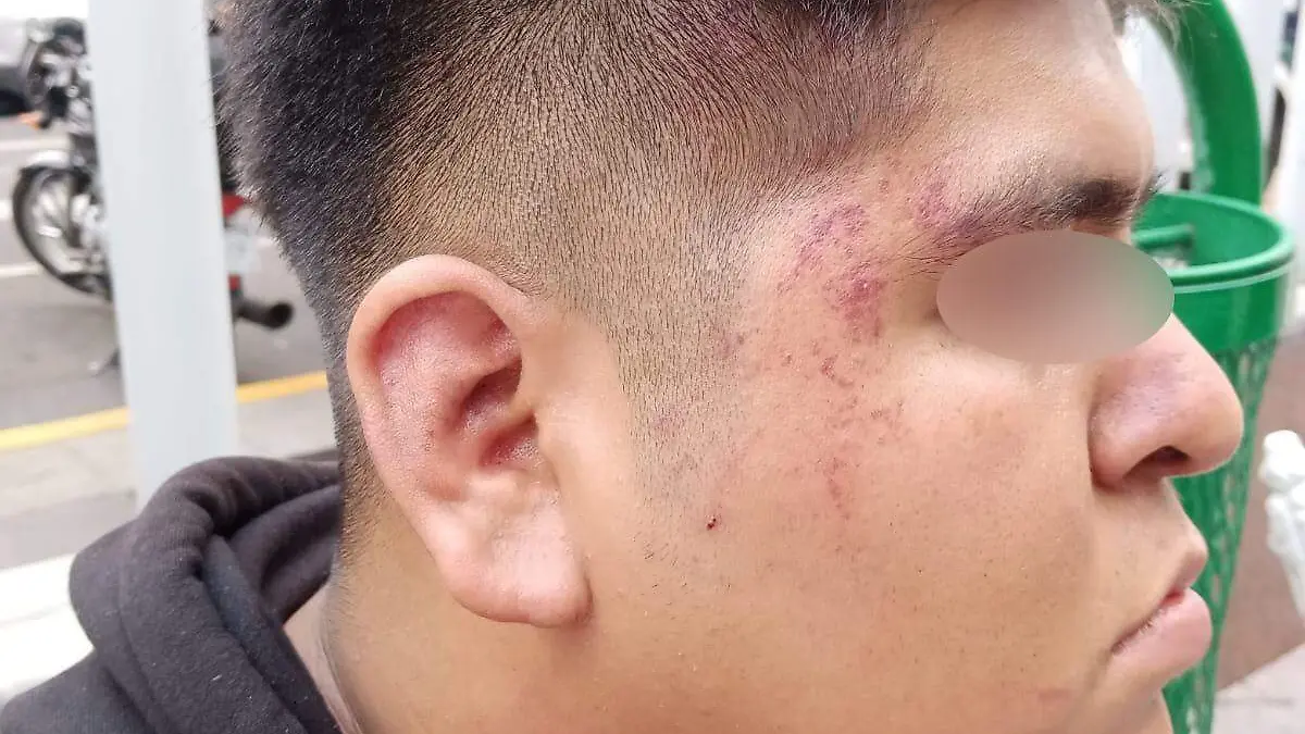 Joven golpeado durante Flow Fest
