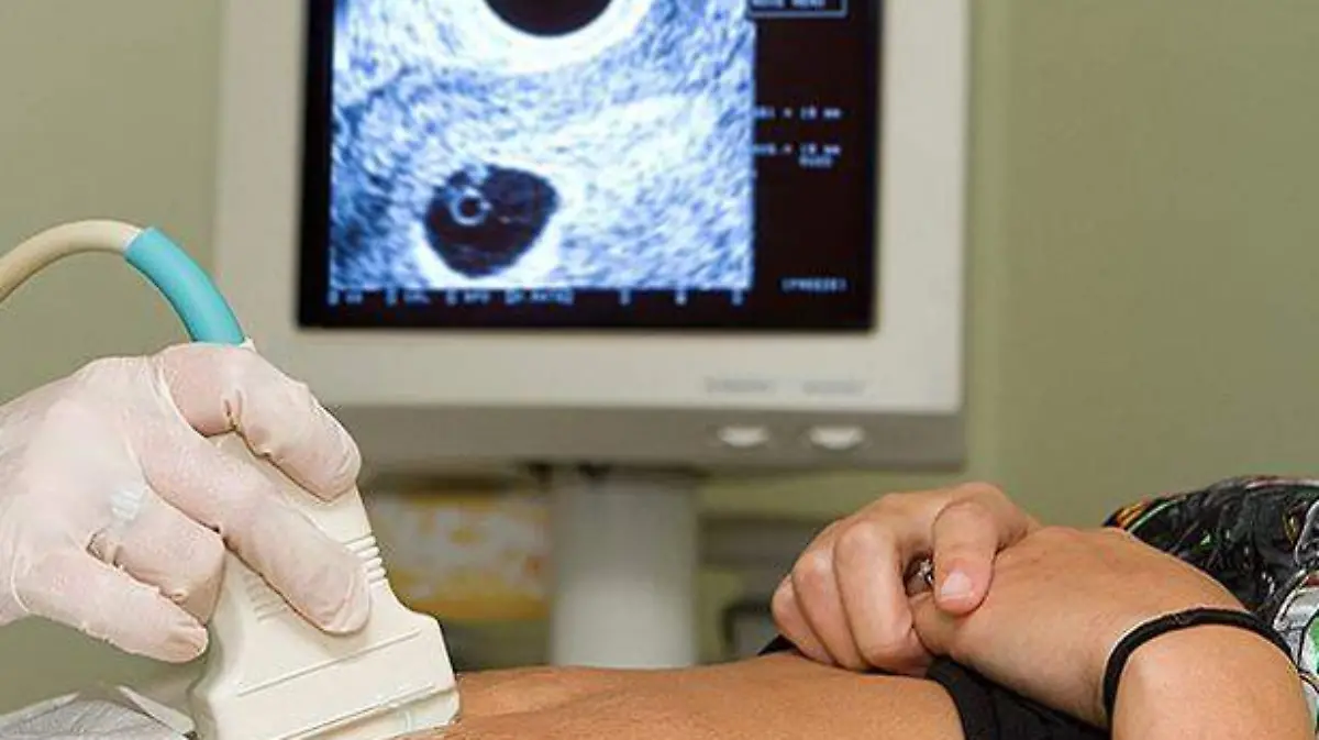 interrupción-embarazo