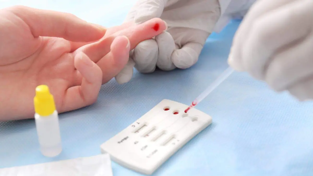 prueba VIH cortesía  Fundación CTR